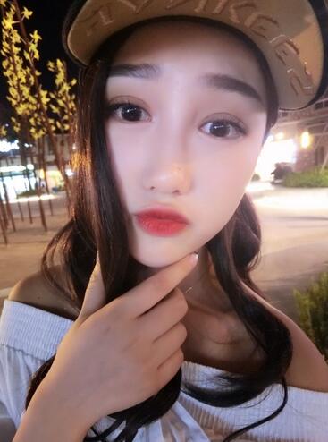 成都玉顏割雙眼皮+開眼角真實案例