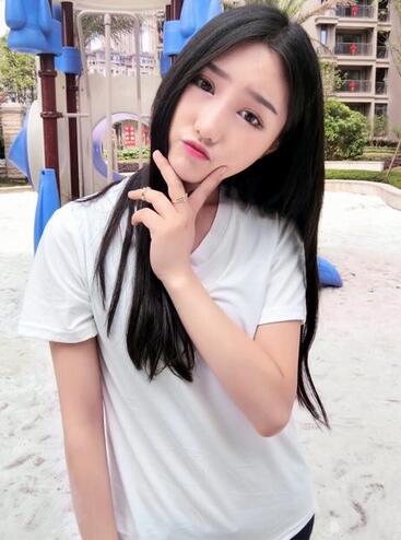 成都玉顏割雙眼皮+開眼角真實案例