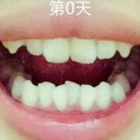 牙齒矯正——成都格林口腔醫(yī)院