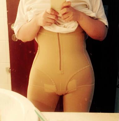 武漢茜韻腰腹環(huán)吸親身經(jīng)歷