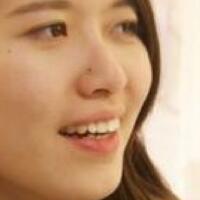 成都牙齒矯正前后對(duì)比圖分享——成都格林口腔