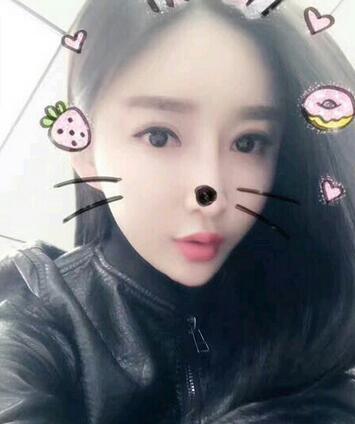 武漢西嬋康美達(dá)拉斯隆鼻+眼部綜合整形