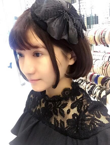 杭州王圣林全切雙眼皮恢復(fù)過程圖