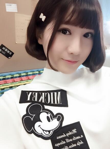 杭州王圣林全切雙眼皮恢復(fù)過程圖