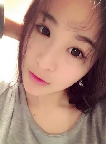 杭州科發(fā)源龍都整形開眼角+割雙眼皮恢復(fù)記錄