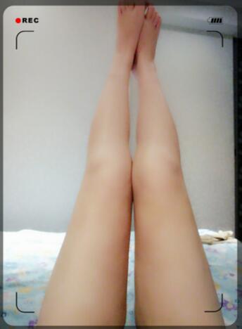 吸脂瘦大腿前后對(duì)比圖，水動(dòng)力吸脂瘦大腿真實(shí)案例多對(duì)比圖經(jīng)歷