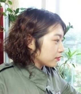 武漢藝齡整形醫(yī)院做駝峰鼻矯正價(jià)格12k，真實(shí)案例恢復(fù)過程圖